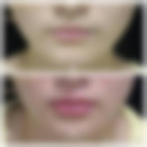 八、上海博爱医院医疗皮肤科真实的顾客评价如下：