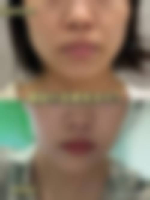 五、韩国dvora整形医院实例