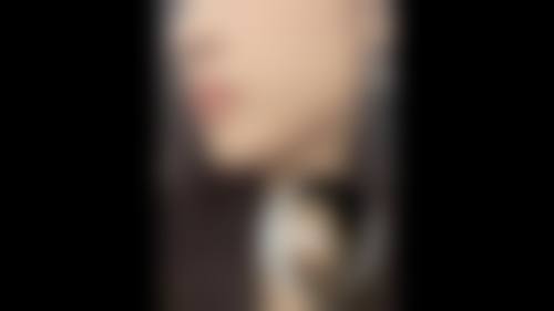 五、韩国枓翰整形外科实例