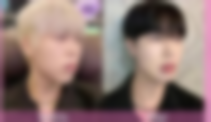 如何睡出迷人双眼皮？遗传因素与其他方法结合