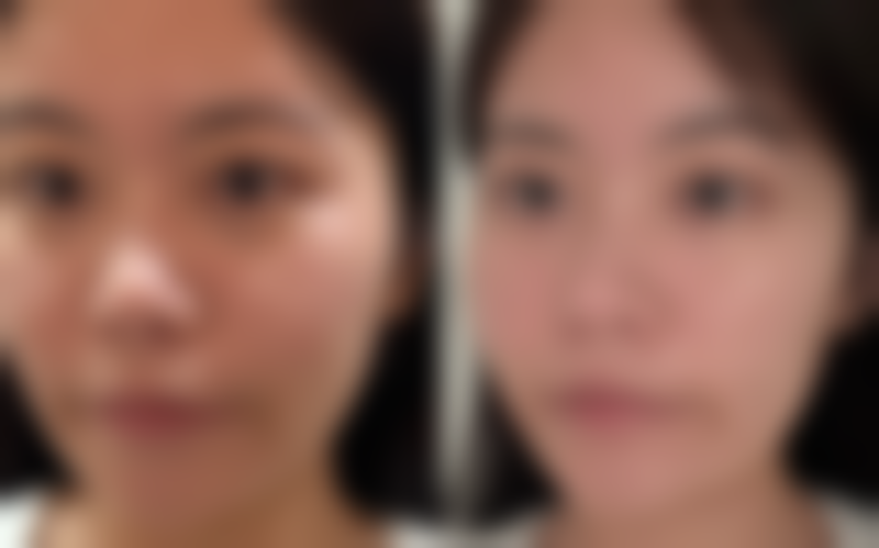 六、沈阳逸美医疗美容诊所怎么预约: