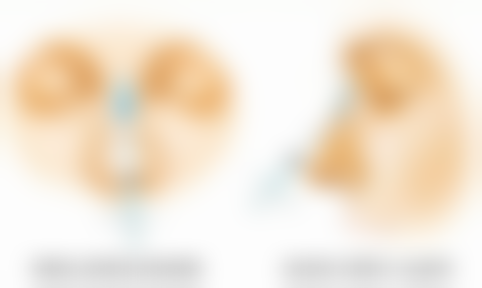 特殊进度消肿情况说明