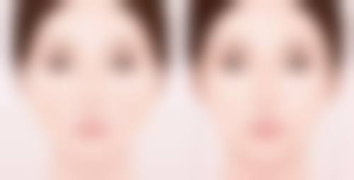 为何手术疤痕会发痒？探究愈合反应、增生刺激等因素及护理缓解办法 