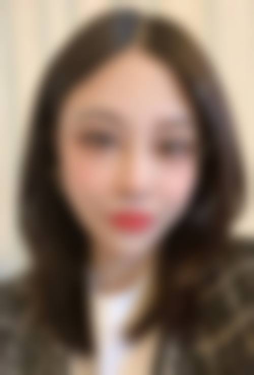 五、成都卡美芝整形医院实例