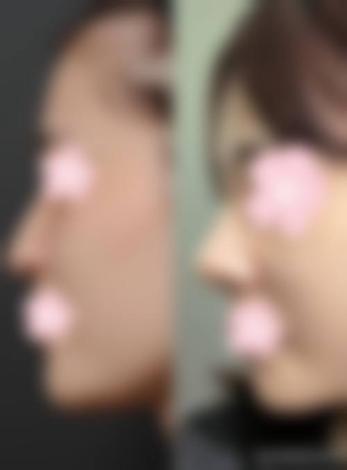 五、白银黛妮整形医院实例