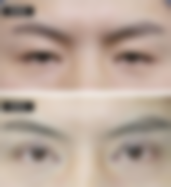 四、白银黛妮整形医院开展的主要项目和特色项目：