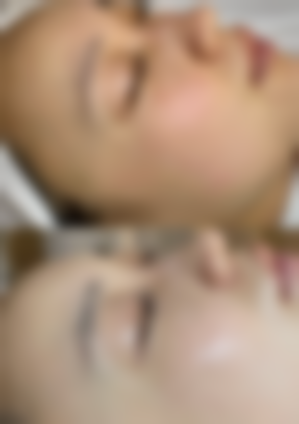 七、扬州恩悦整形医院价格表：（仅供参考）