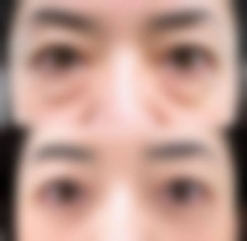 五、广东广州国人医美整形医院实例