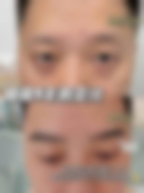 五、南宁贞韩植发技术有限公司南宁医疗美容诊所实例