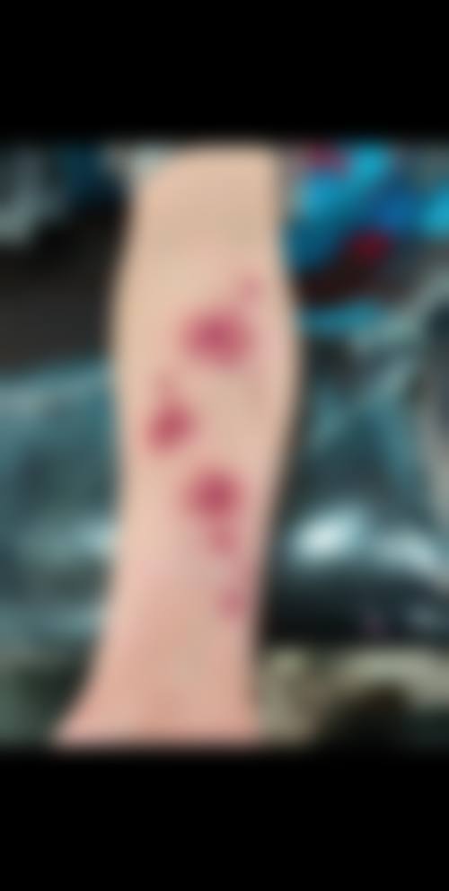 李镇河医生口碑和评价