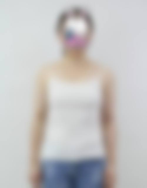 陈秀荣医生项目价格表参考