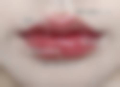 七、厦门张铭医疗美容诊所价格表：（仅供参考）