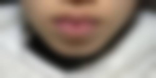 六、吴江市第二人民医院整形美容科价格表：（仅供参考）