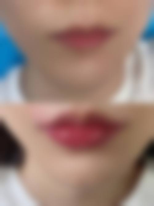 五、吴江市第二人民医院整形美容科怎么预约：