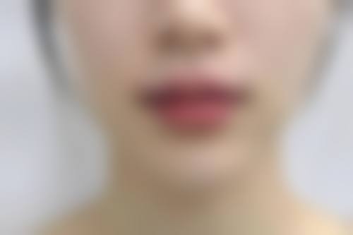 七、吴江市第二人民医院整形美容科真实的顾客评价如下：