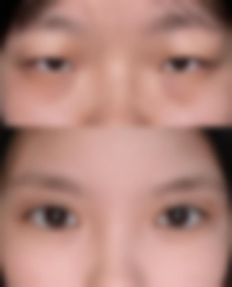 李镇河医生实例