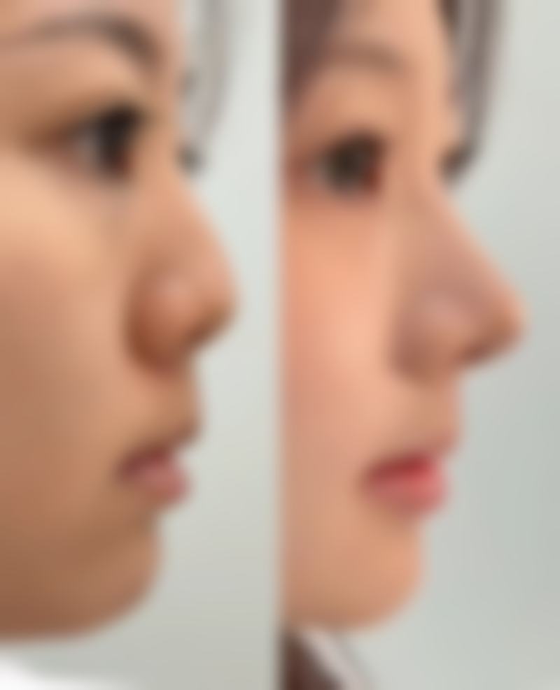 七、鸡西红丽医疗美容门诊部真实的顾客评价如下：