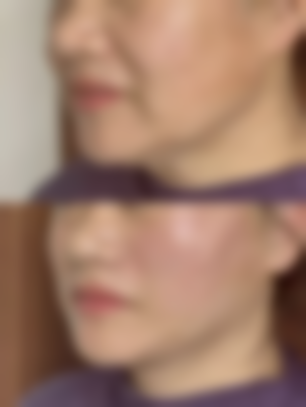 七、韩国Beauty classic整形医院价格表：（仅供参考）