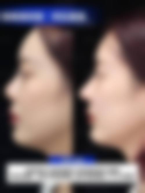 六、昆山瑞希美医疗美容诊所价格表:(仅供参考)