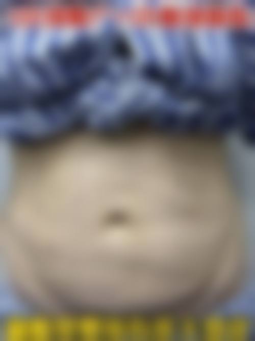 五、大连奈思美整形医院实例