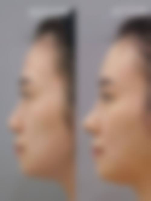 五、深圳明伦医疗美容门诊部实例