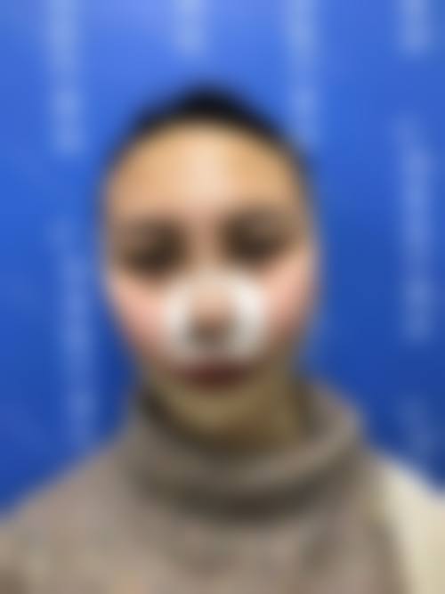 七、深圳明伦医疗美容门诊部价格表：（仅供参考）