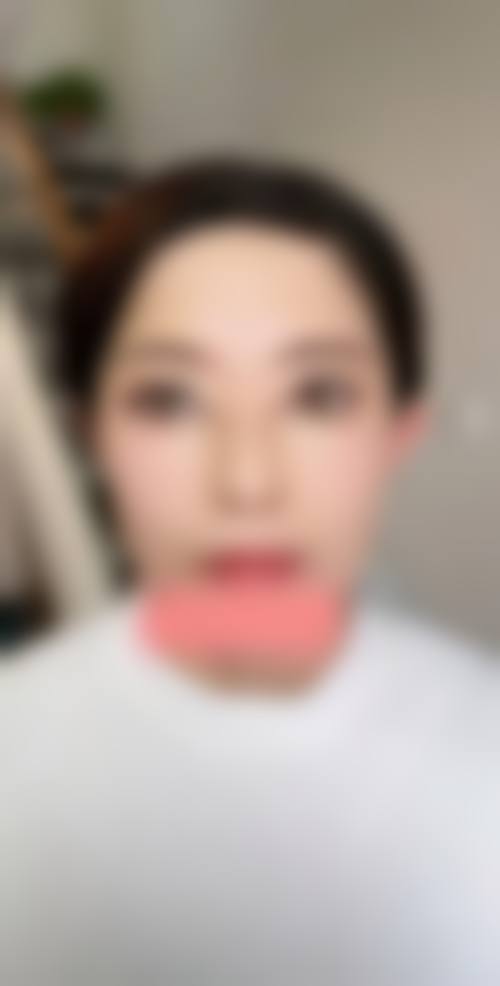 郑小华医生项目价格表参考