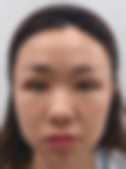 郑小华医生口碑和评价