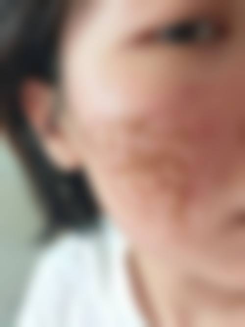 五、苏州肤康医美中 心诊所怎么预约：