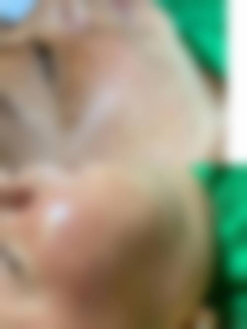 七、丹阳星范整形美容门诊部真实的顾客评价如下：