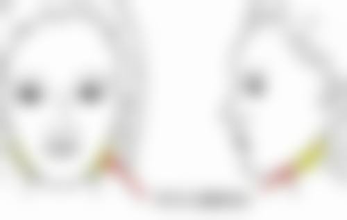 曼托假体隆胸究竟好不好？安心便捷让人放心