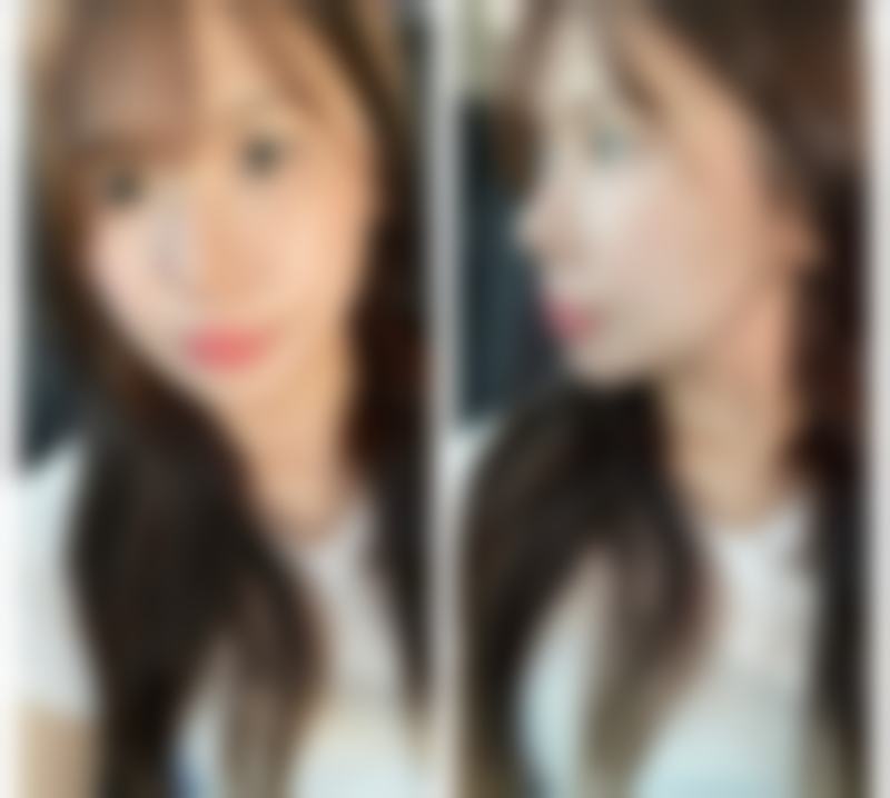 李尚俊医生怎么样可靠吗？