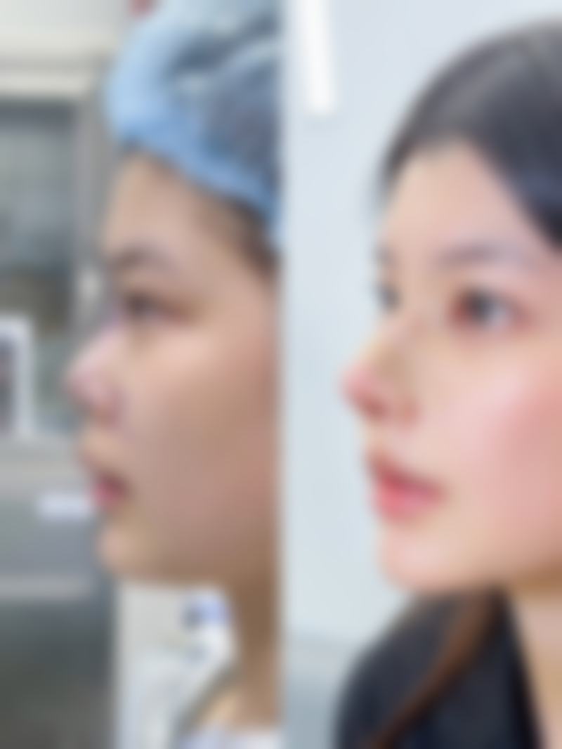 国内部分肋软骨隆鼻机构医生，实力助你变得更美！