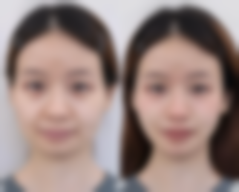 六、怀化曹家医疗美容门诊部怎么预约：