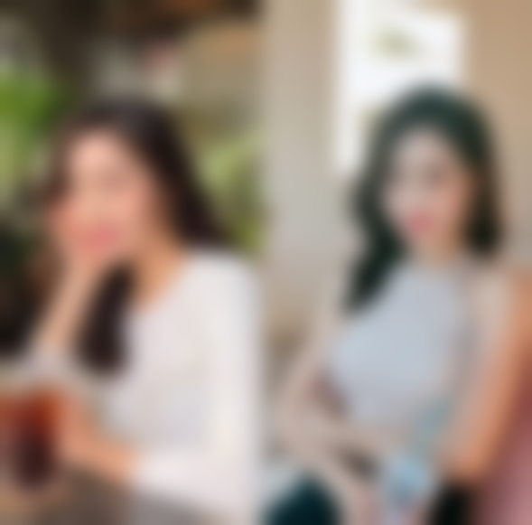 肋软骨隆鼻适合谁？这些人群别错过！