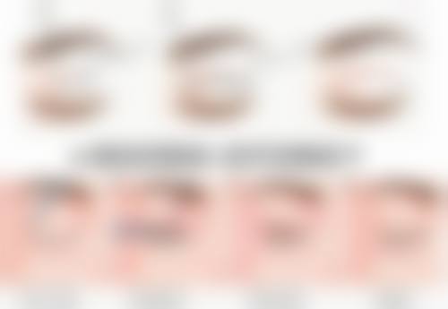 如何选择适合自己的治疗方案?