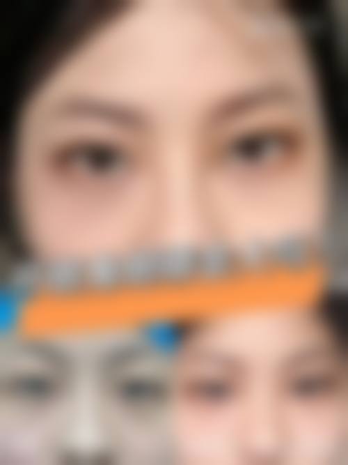 八、成都武侯菲格医疗美容整形医院真实的顾客评价如下: