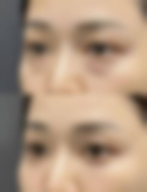 四、韩国jeef皮肤科实例