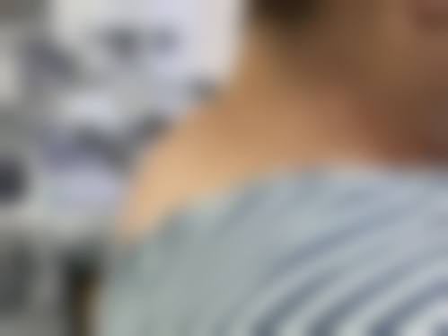 五、韩国jeef皮肤科怎么预约：