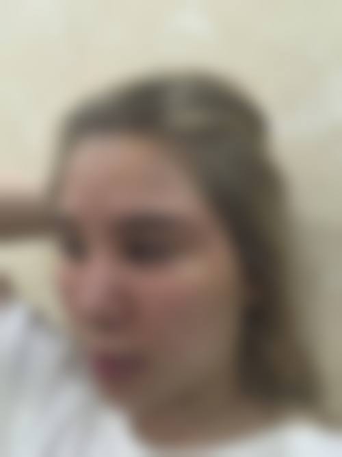 八、北京时光臻美医疗美容诊所真实的顾客评价如下：