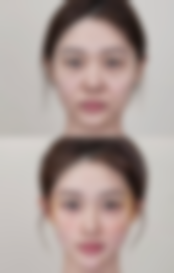 五、郑州方胜整形医疗美容诊所实例