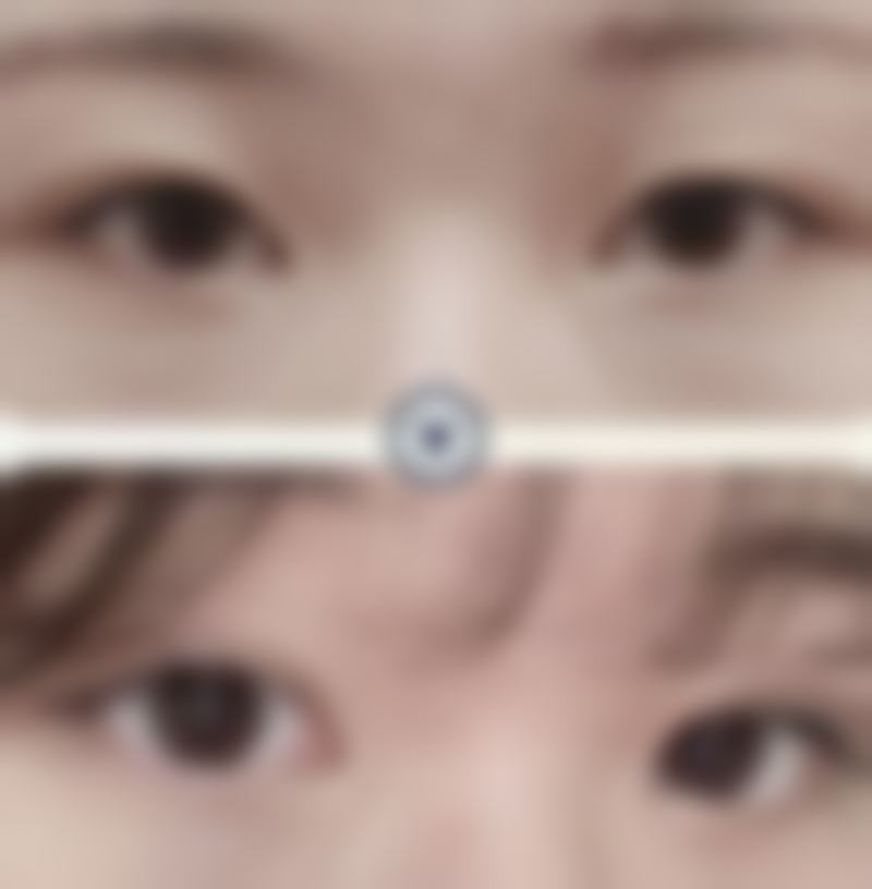 五、咸宁韩美整形美容医院实例