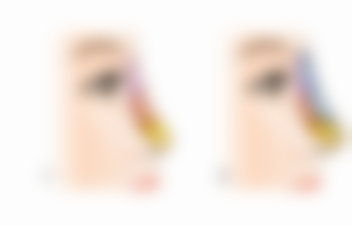 私人工作室打瘦脸针，医生技术有保护吗？正规机构专精医生更靠谱