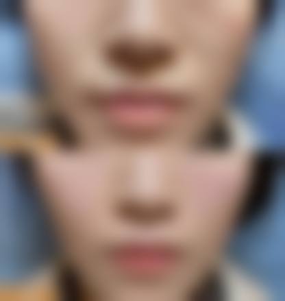 六、深圳如一医疗美容诊所怎么预约: