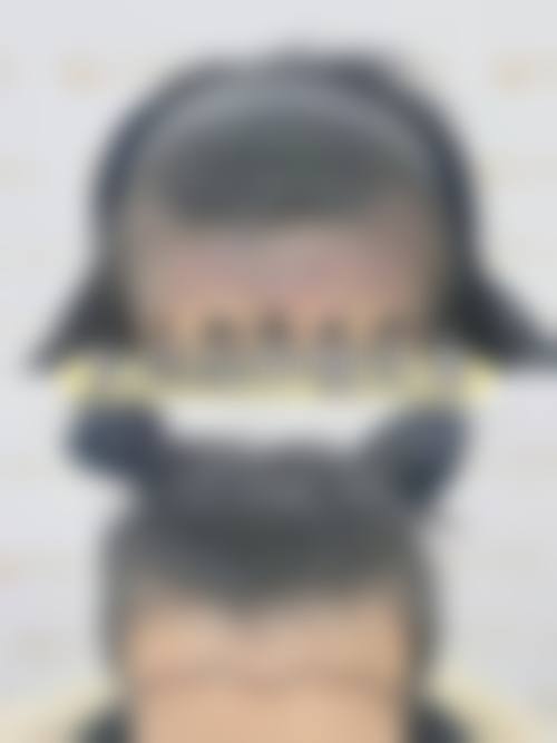 八、沈阳显赫植发医院真实的顾客评价如下：