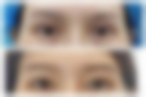 七、重庆杨东运医疗美容诊所价格表：（仅供参考）