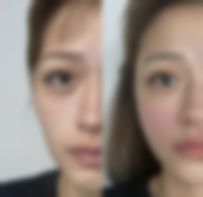 七、深圳如一医疗美容诊所价格表:(仅供参考)