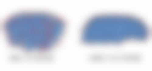 眼袋周围有皱纹很烦恼？教你巧用天然食材与按摩手法，淡化眼袋皱纹焕光彩 