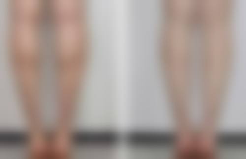 按摩手法助力，轻松赶走眼袋皱纹