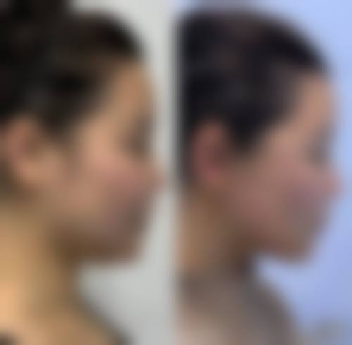 八、南昌简一整形医院真实的顾客评价如下: